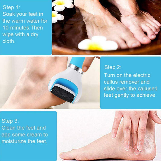 0229 Electronic Dry Foot File Callous Remover For Feet Electric Foot With Roller Hard And Dead Skin- Regular Coarse Baby Smooth Feet In Minutes. For In Home Padicure Foot Care Battery Powered Usb (Battry Not Included)